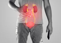 What are the symptoms of a kidney stone? What is the cure for it?